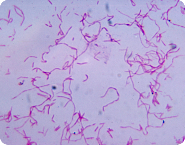 Fusobacterium nucleatum