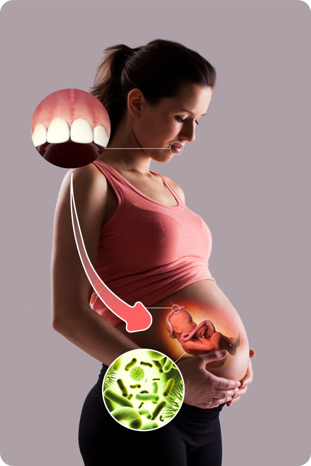 Periodontal Disease and Pregnancy