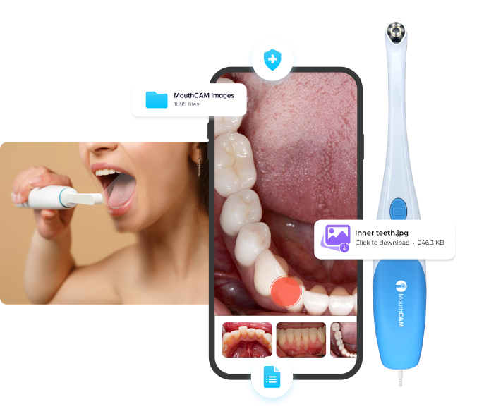 Dental Monitoring Services