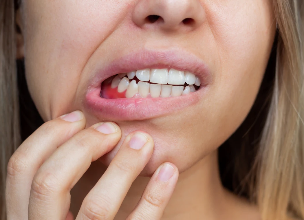 Achieve Optimal Oral Health