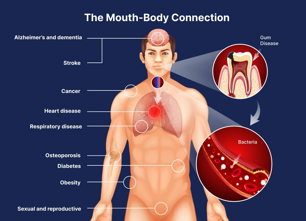 Your oral health and mouth-body connection