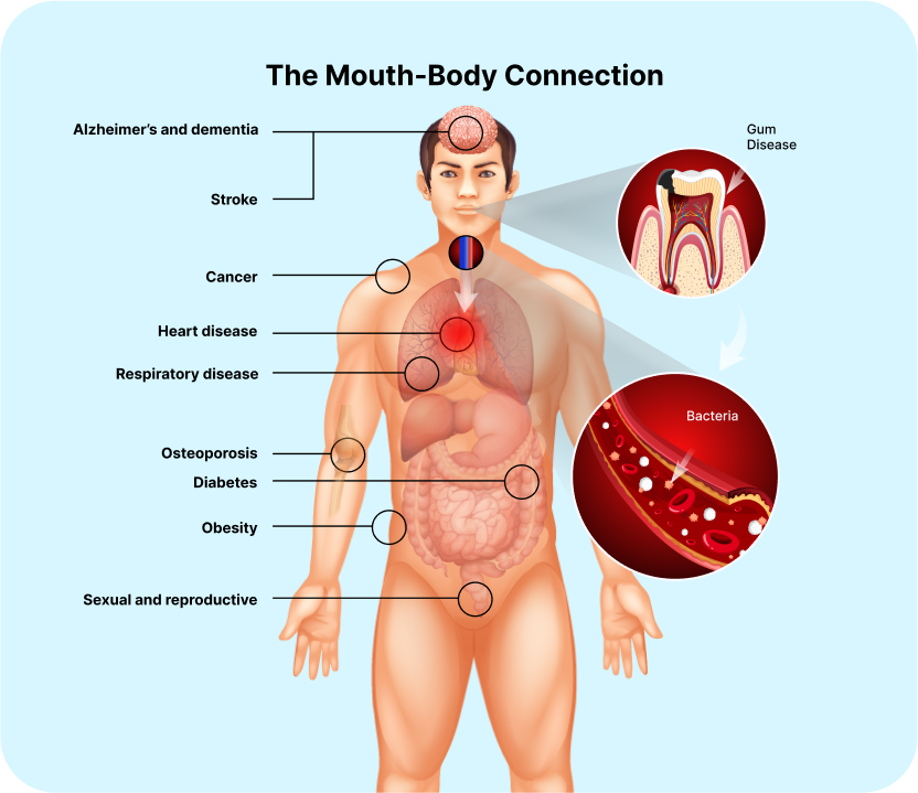 MouthCAM