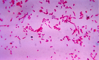 Fusobacterium nucleatum