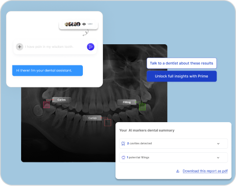 AI Powered Dental Analysis