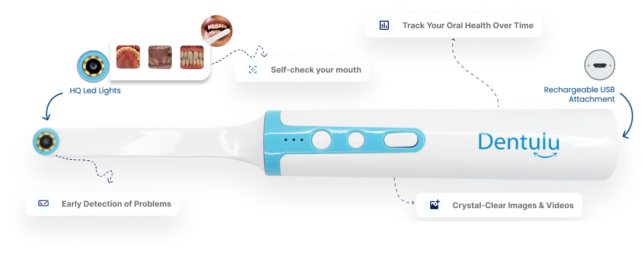 MouthCAM