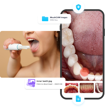 MouthCAM Usage