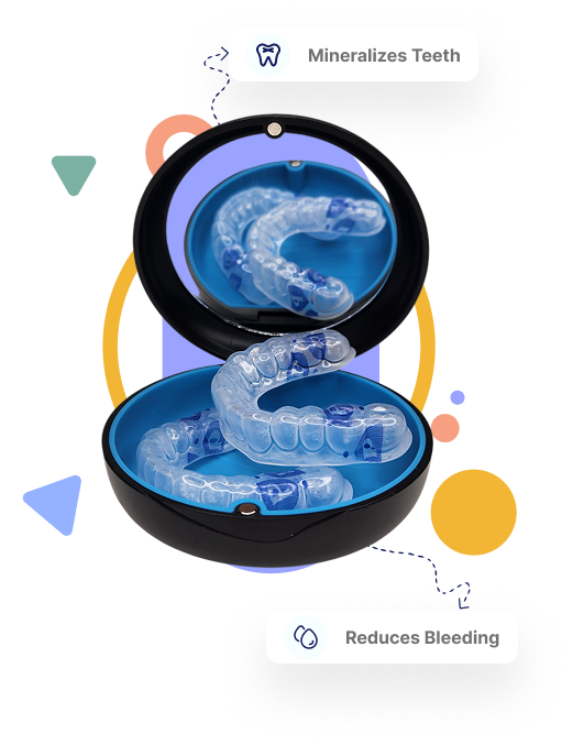 Remineralization Trays