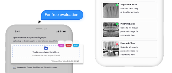 Upload X-rays