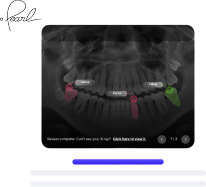 AI X-ray Review