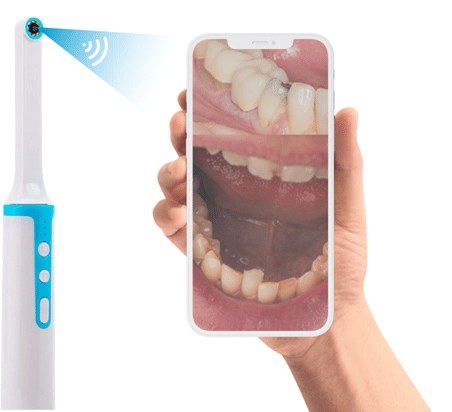 connect your smart phone with dental camera - mouthcam